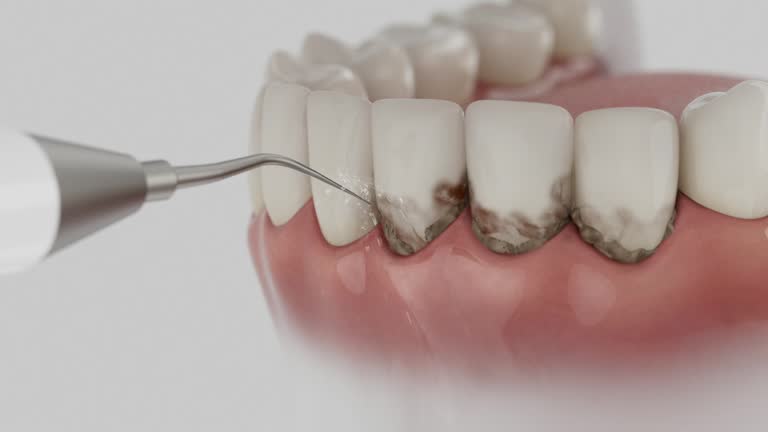 Reliable Dental Implants contractor in Leesport, PA by Smile Center Dentistry